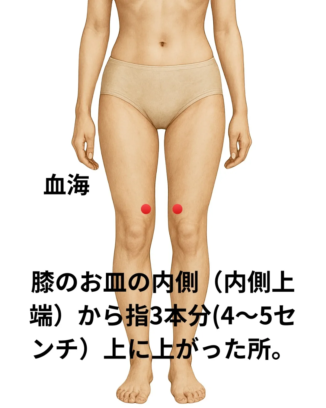 子宮内膜症とはどんな病気?