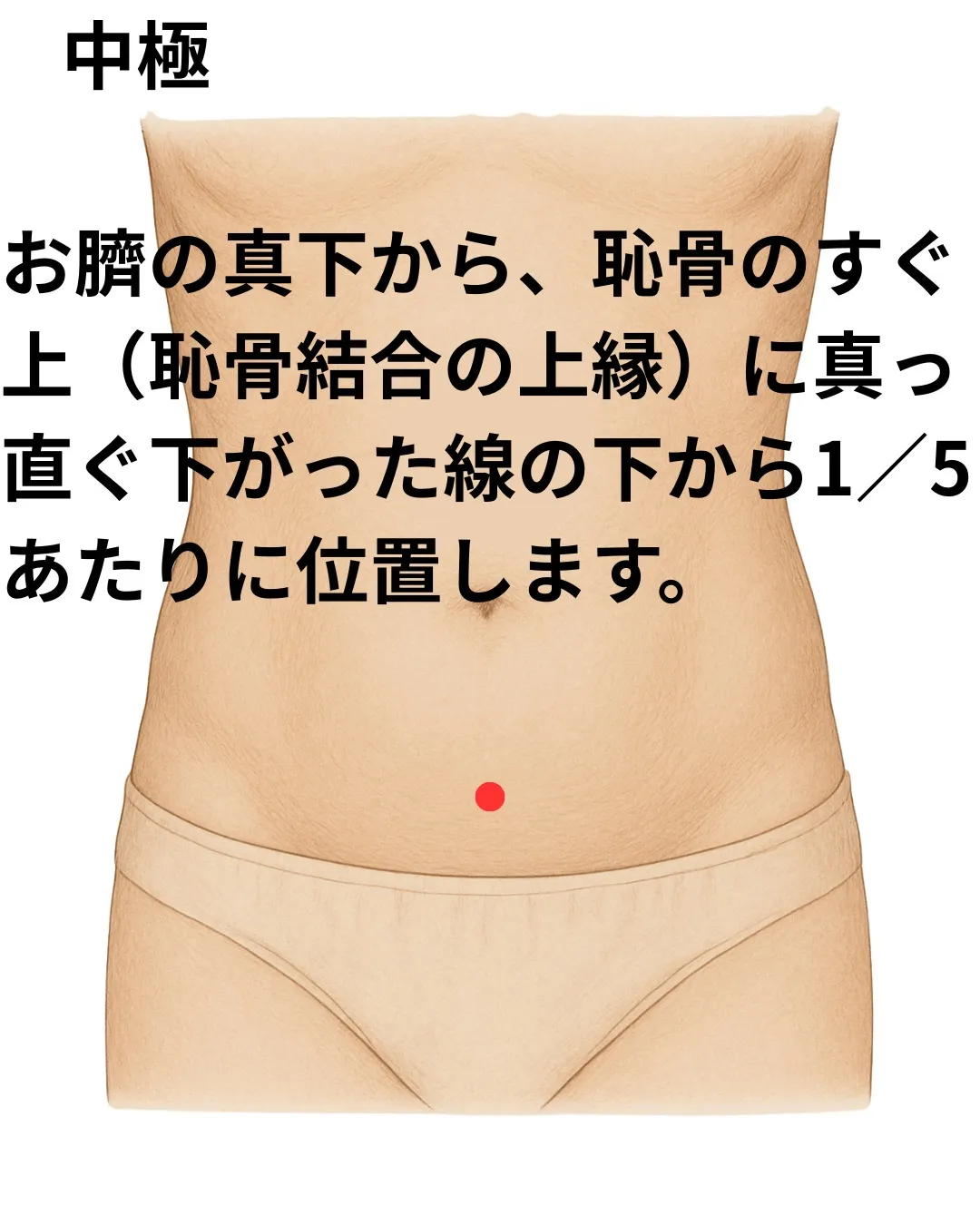 子宮内膜症とはどんな病気?