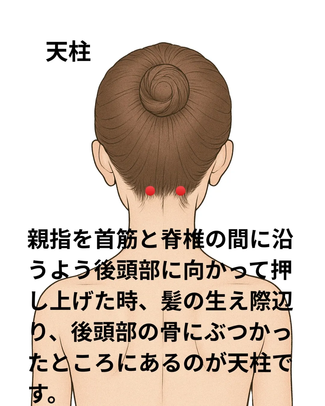 冬場に片頭痛が増えやすい理由