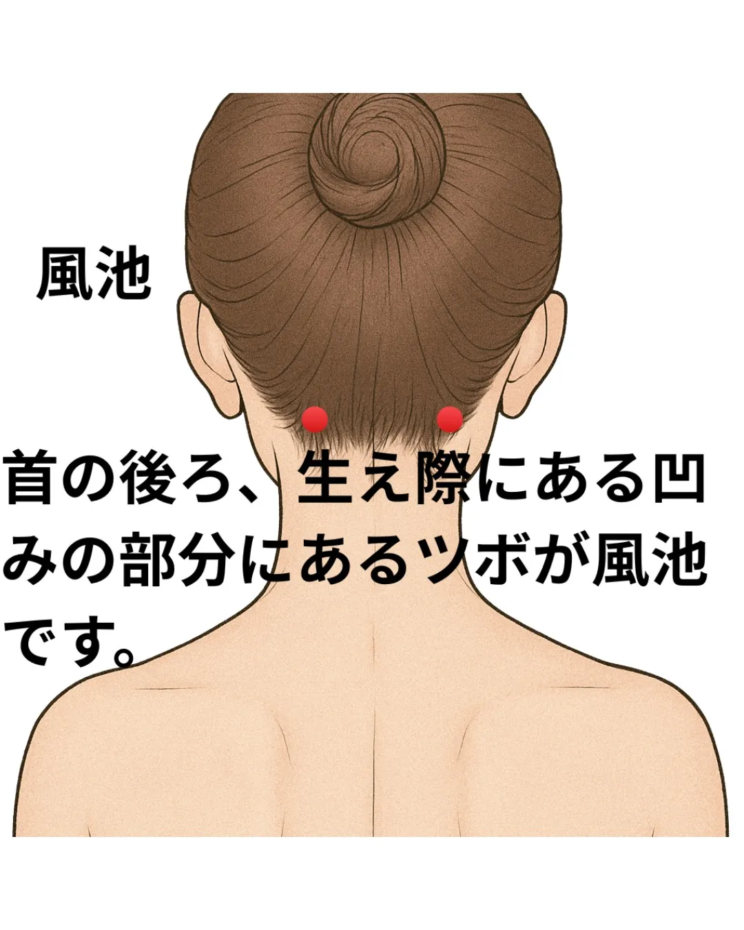 冬場に片頭痛が増えやすい理由